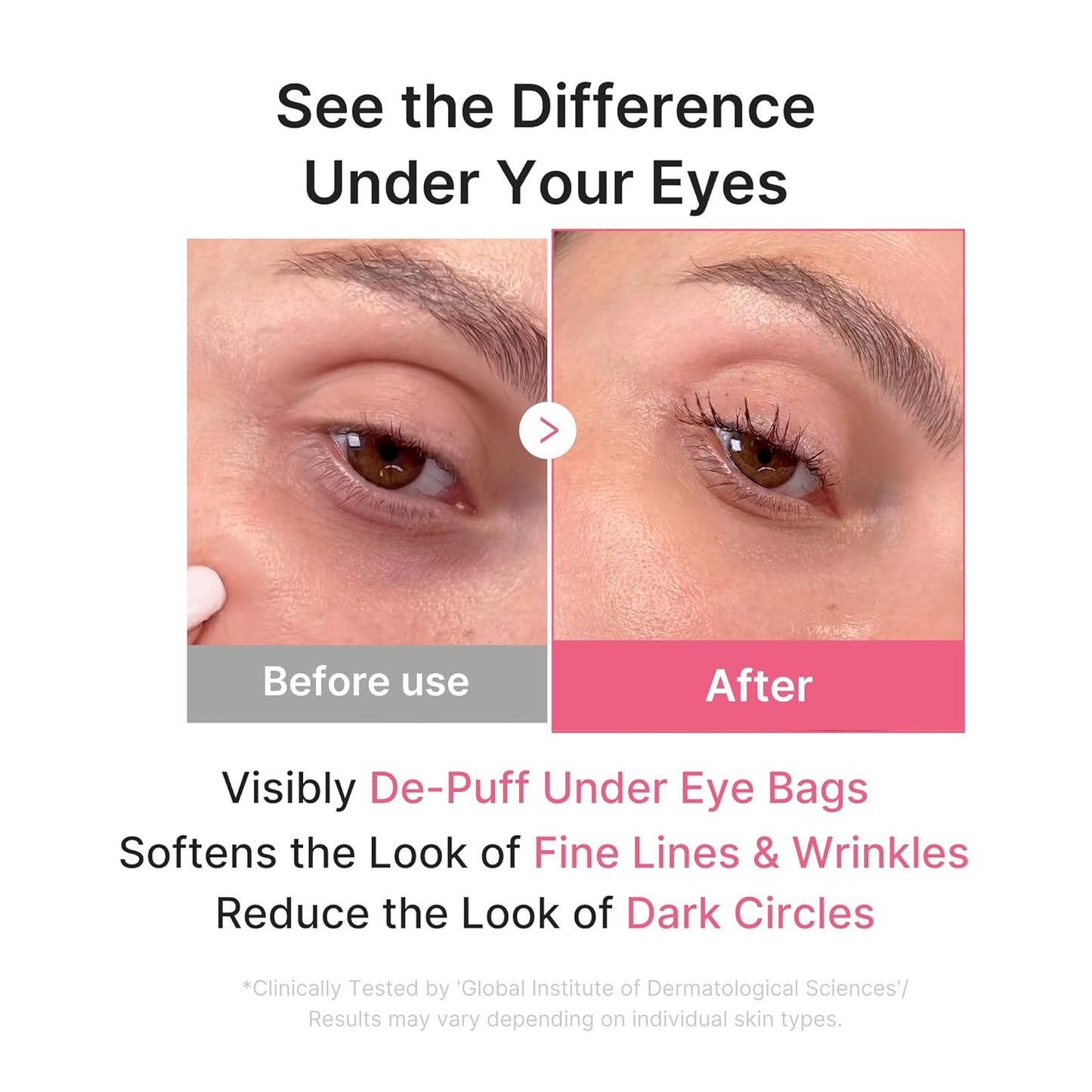 Hotmedicube Jelly Eye Mask PDRN Pink Collagen | Hydrogel Eye Patches with PDRN, Collagen, NAD | Refreshing for Puffy, Tired Eyes | Firming for Look of Wrinkles, Fine Lines | Korean Skincare (50 Pairs)