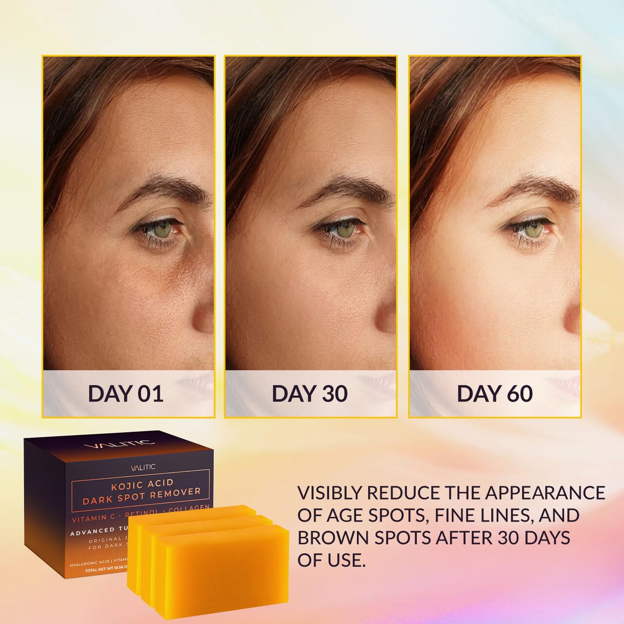 HotValitic Kojic Acid Dark Spot Remover Soap Bars with Vitamin C, Retinol, Collagen, Turmeric - Original Japanese Complex Infused with Hyaluronic Acid, Vitamin E, Shea Butter, Castile Olive Oil (3 Pack)