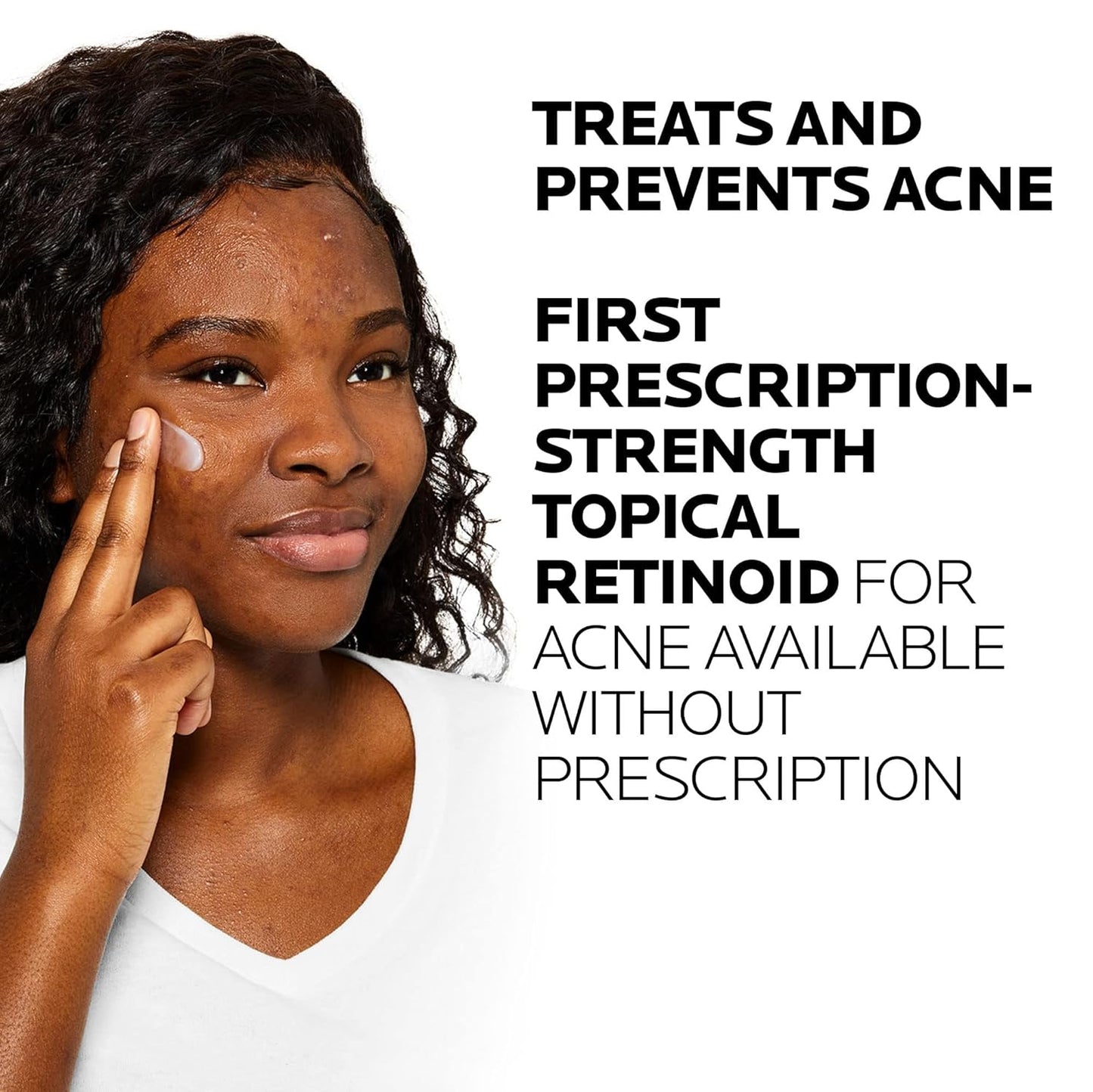 HotLa Roche-Posay Effaclar Adapalene Gel 0.1% Acne Treatment, 1.6oz | Retinoid cream acne medication gel for blackheads and whiteheads. Oil free formula helps clear blemishes and clogged pores.