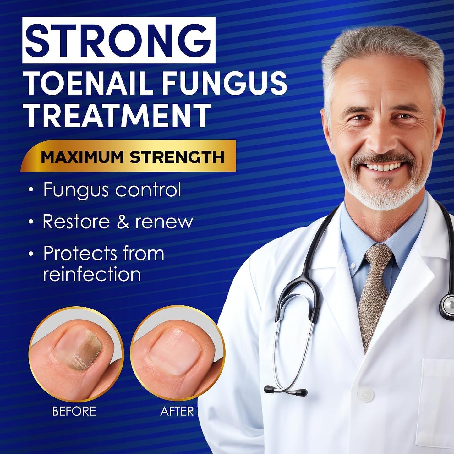 HotToenail Fungus Treatment Extra Strength – VTROUY 2 Bottle Nail & Toe Solution with Undecylenic Acid 25% and Tea Tree Oil 15ml 2Pcs