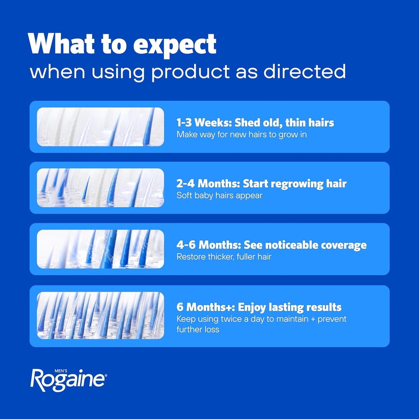 HotMen's Rogaine Extra Strength 5% Minoxidil Solution, 3 Mo Supply, 3x 2 Fl Oz