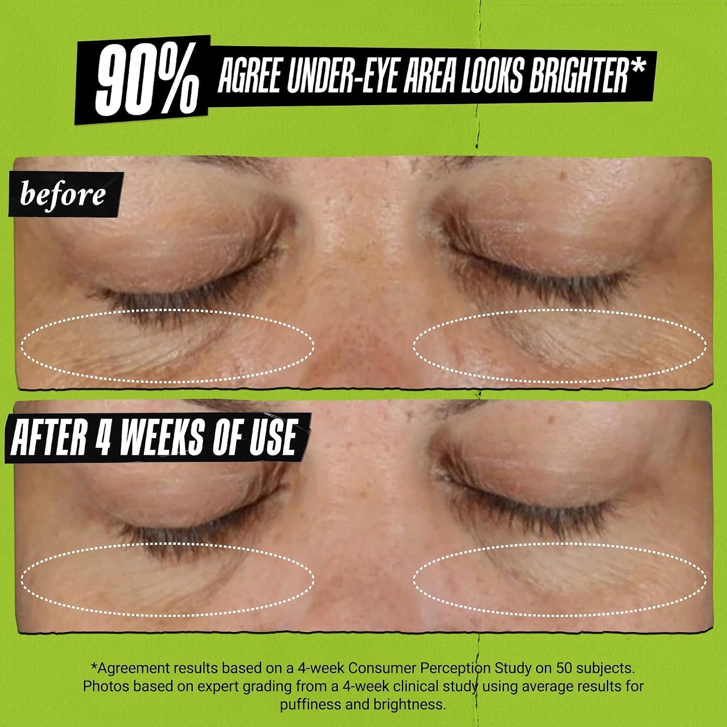 HotKiehl's Avocado Eye Treatment, Under Eye Cream for Puffiness and Dark Circles, with Caffeine to Correct Bags, 99% Naturally Derived Non-Toxic Formula