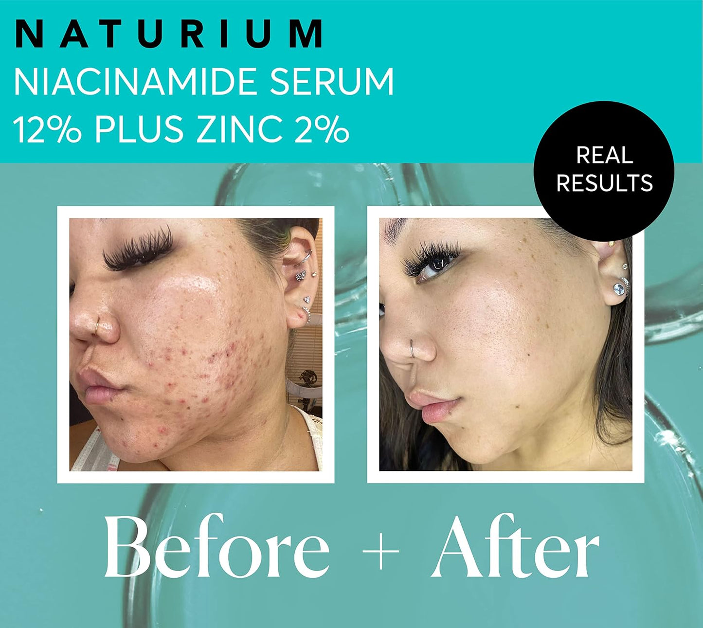 HotNaturium Niacinamide Face Serum 12% Plus Zinc 2%, Anti-Aging, Pore Minimizer & Dark Spot Corrector with Hyaluronic Acid & Vitamin E, Vegan & Cruelty-Free, 1 oz