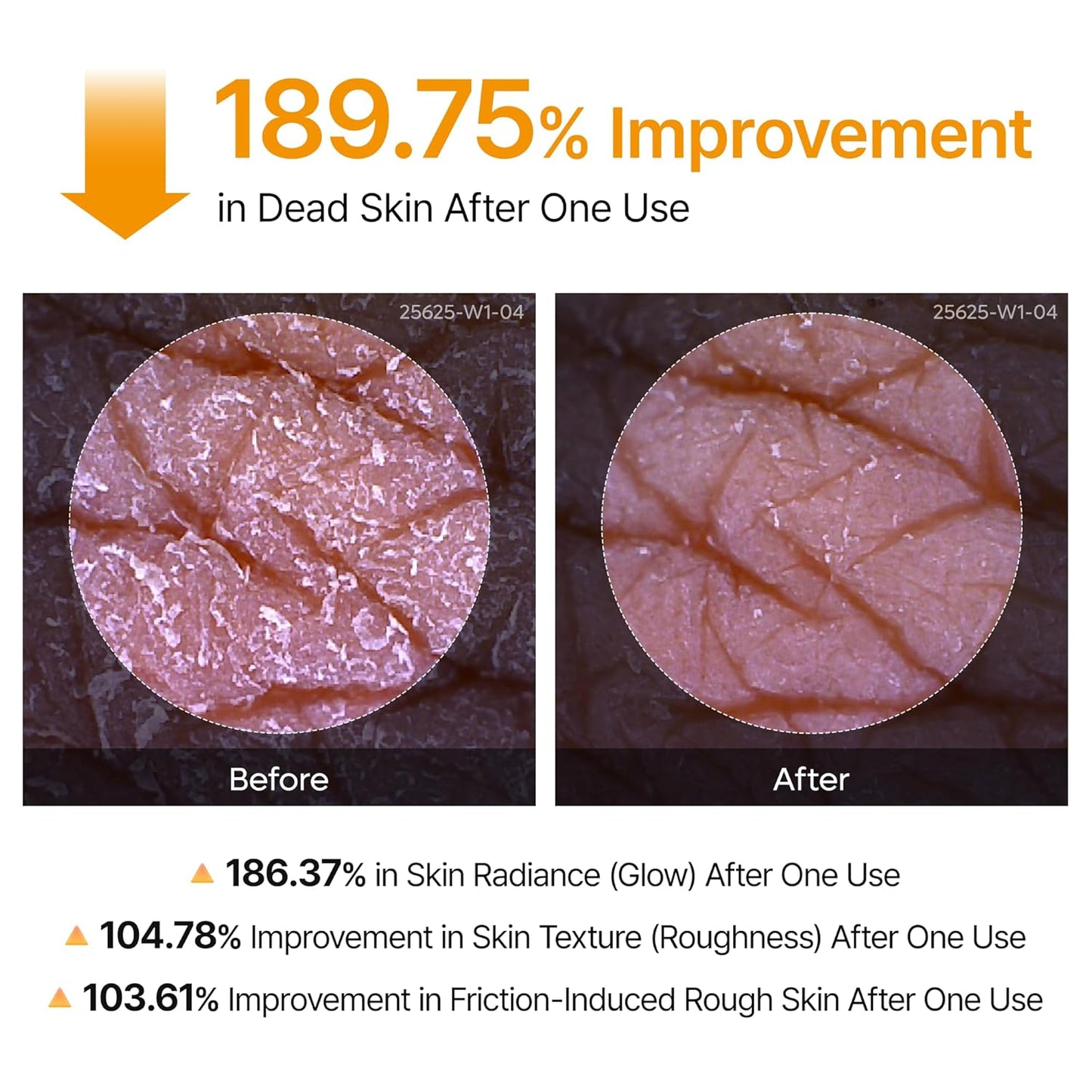 HotDr.Melaxin Peel Shot Kojic Acid Turmeric Body Exfoliator Spray 6.76 fl.oz - AHA PHA Niacinamide Body Scrub for KP Bumps, Dark Spots, Uneven Skin Tone, Dead Skin, Korean Skin Care