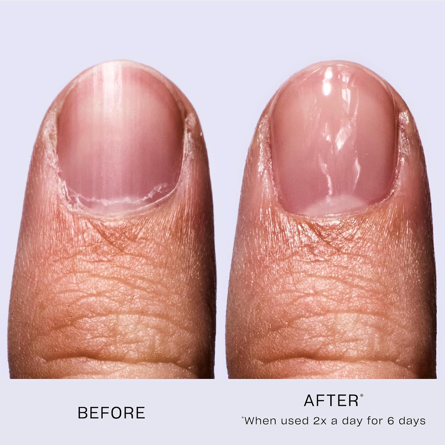 HotOPI Nail Envy Nail Strengthener | Clear & Opaque Crème Nail Polish Treatment | Strengthen Weak & Thin Nails