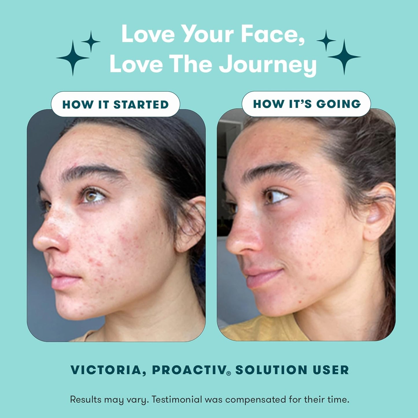 HotProactiv 3 Step Acne Treatment - Benzoyl Peroxide Face Wash, Repairing Acne Spot Treatment for Face and Body, Exfoliating Toner - 30 Day Complete Acne Skin Care Kit