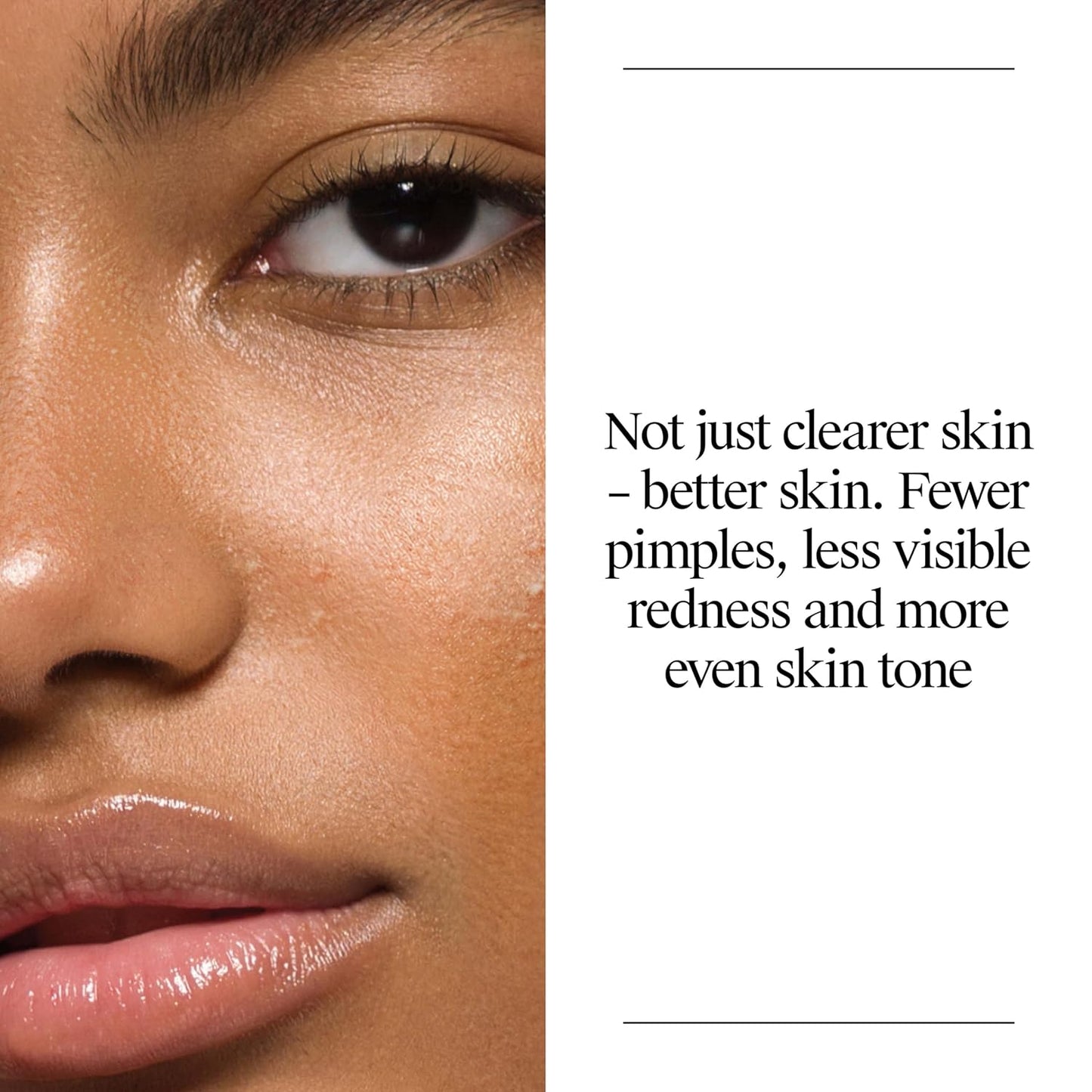 HotNeutrogena Oil Free Acne Face Wash for Oily Skin, Salicylic Acid Cleanser, Noncomedogenic, Residue Free, Easy Pump Bottles, 9.1 Fl Oz, 3 Count