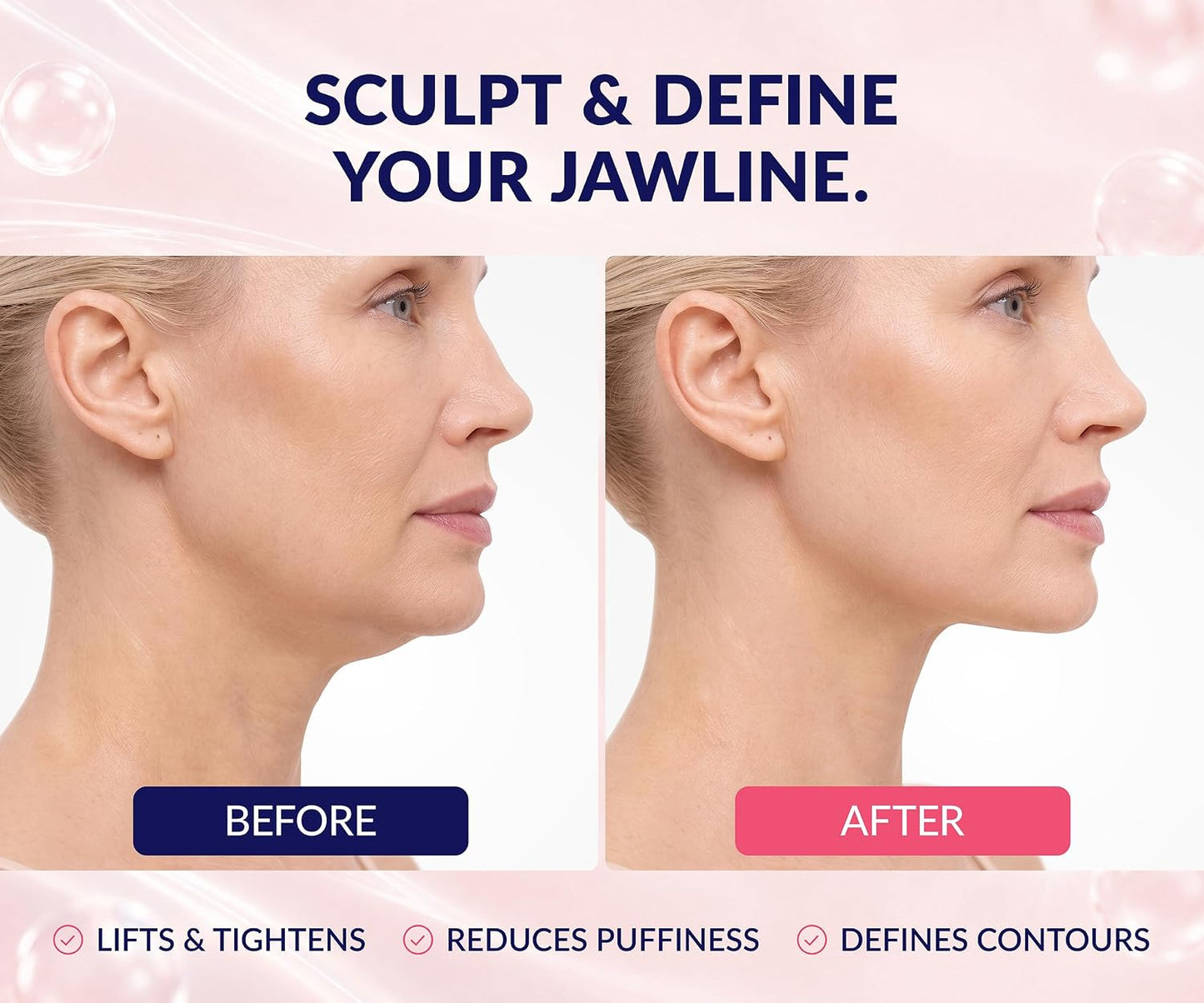 HotStylia V Line Lifting Collagen Mask - Lift, Firm & Contour Jawline - Tightening Double Chin Strap with Hyaluronic Acid & Aloe - Neck Tightening and Lifting Mask - Jawline Shaper Face Lift Tape (10PC)