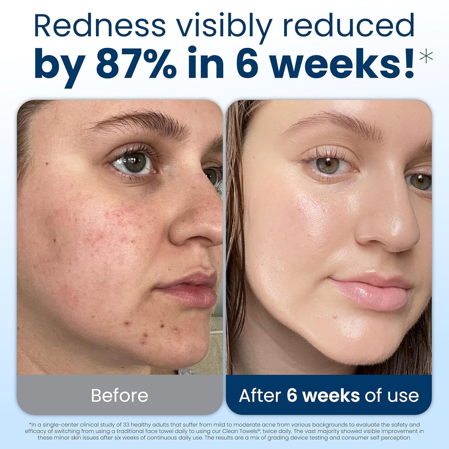 HotClean Skin Club Clean Towels XL®, 100% USDA Biobased Face Towel, Disposable Face Towelette, Eczema Association Accepted, Makeup Remover Dry Wipes, Ultra Soft, 50 ct per pack, 2 Packs, 100 Ct Total