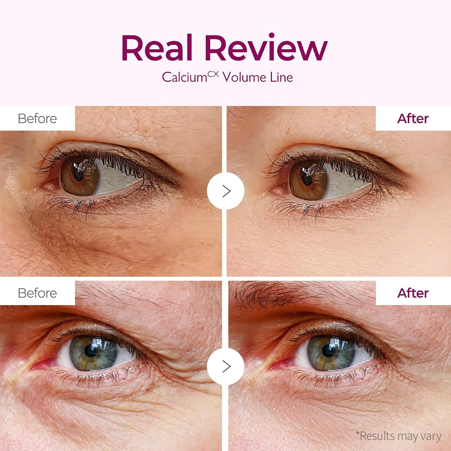 HotDr.Melaxin Calcium Volume Under Eye Patches for Puffy Eyes & Dark Circles, Hydrogel Eye Mask for Wrinkles, Fine Lines & Sagging Skin, Firming Collagen Eye Patch, Korean Skin Care (60 Count)