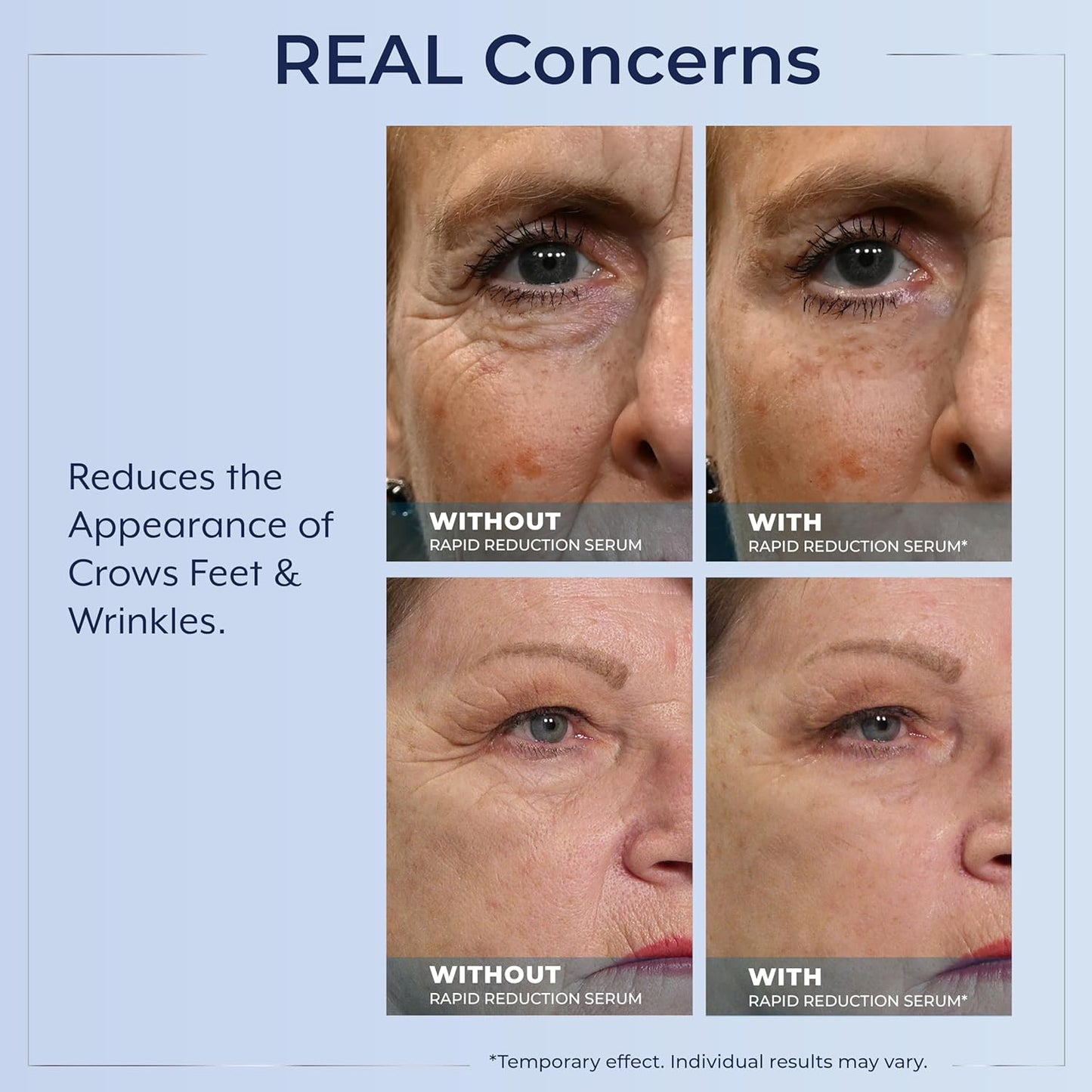 HotPlexaderm Rapid Reduction Eye Serum - Visibly Reduces Under-Eye Bags, Wrinkles, Dark Circles, Fine Lines & Crow's Feet Instantly, Anti Aging Wrinkle Remover for Face, Full Size Tube