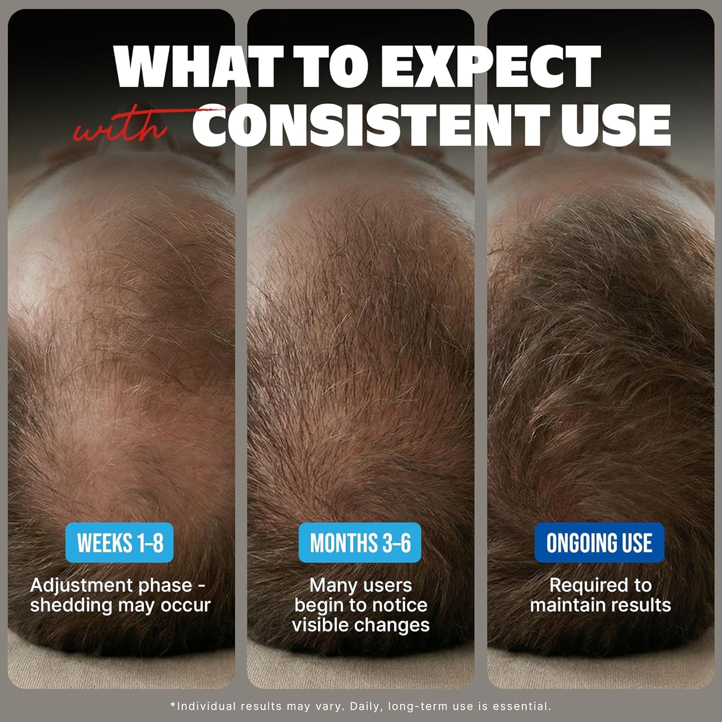 HotKirkland Minoxidil for Men Liquid, Extra Strength Hair Regrowth Treatment 5%, 6 Months Supply - Upgraded Dropper Applicator and Bonus Free Guide Included