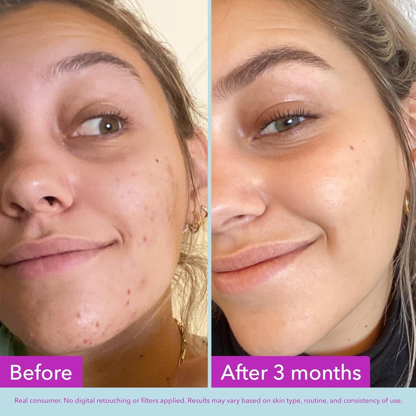 HotGood Molecules Niacinamide Brightening Toner - Toner for Face with Niacinamide and Arbutin for Skin Tone Balancing - Minimizes the Look of Pores, Facial Skin Care