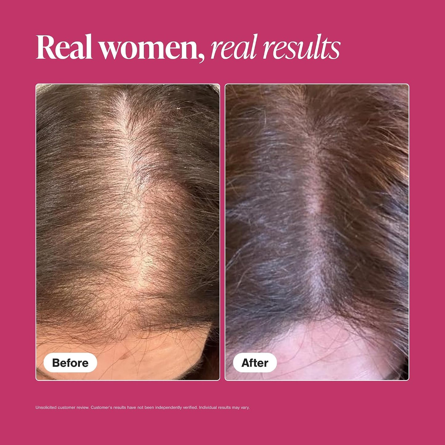HotViviscal Hair Growth Supplements for Women, Thicker Fuller Hair Support for Thinning Hair and Hair Loss, with Biotin and Marine Collagen, Drug-Free, 180 Tablets, 90-Day Supply