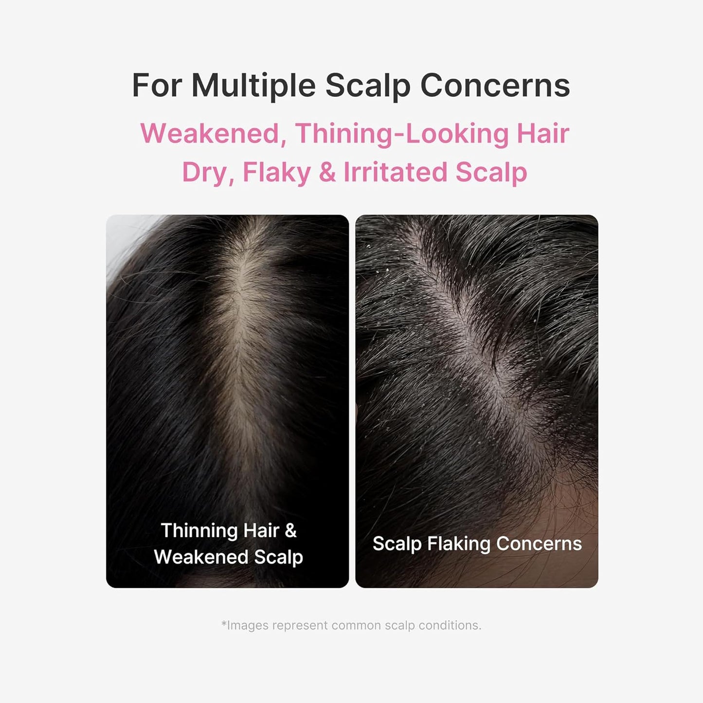 Hotmedicube Scalp Serum with Rosemary PDRN | Non-Greasy, Lightweight Serum for Thicker, Fuller, Denser-Looking Hair | Scalp Treatment for Flake-Prone Scalp, Soothing | Korean Hair Care, 20ml