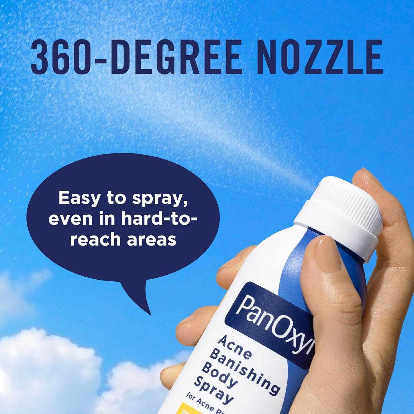 HotPanOxyl Acne Banishing Body Spray with 2% Salicylic Acid, Pimple Treatment Spray to Clear Stubborn Breakouts, 360-Degree Spray Nozzle, Skin-Brightening Niacinamide, Vitamin C, Witch Hazel, Aloe, 6 Oz