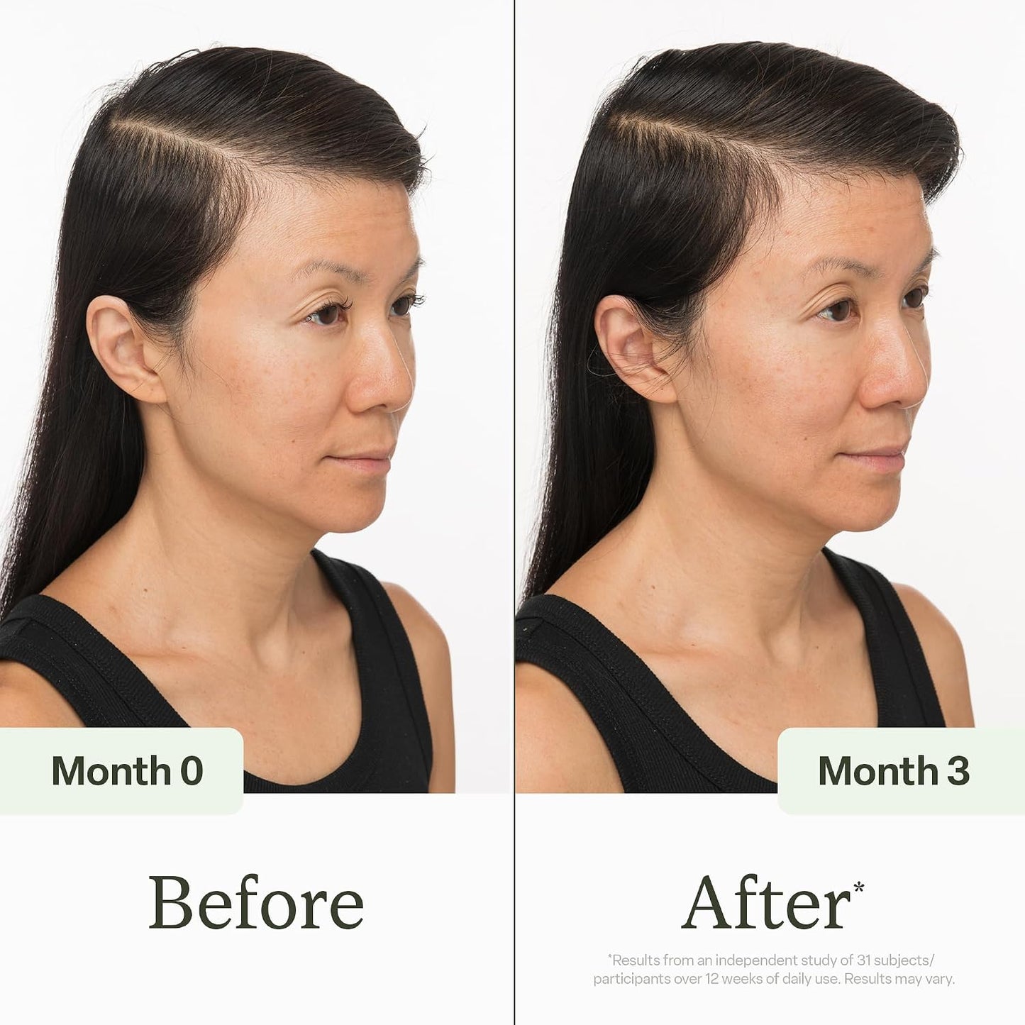 HotDivi Scalp Serum | To Promote Fuller-Looking Hair with Peptides | 30ml