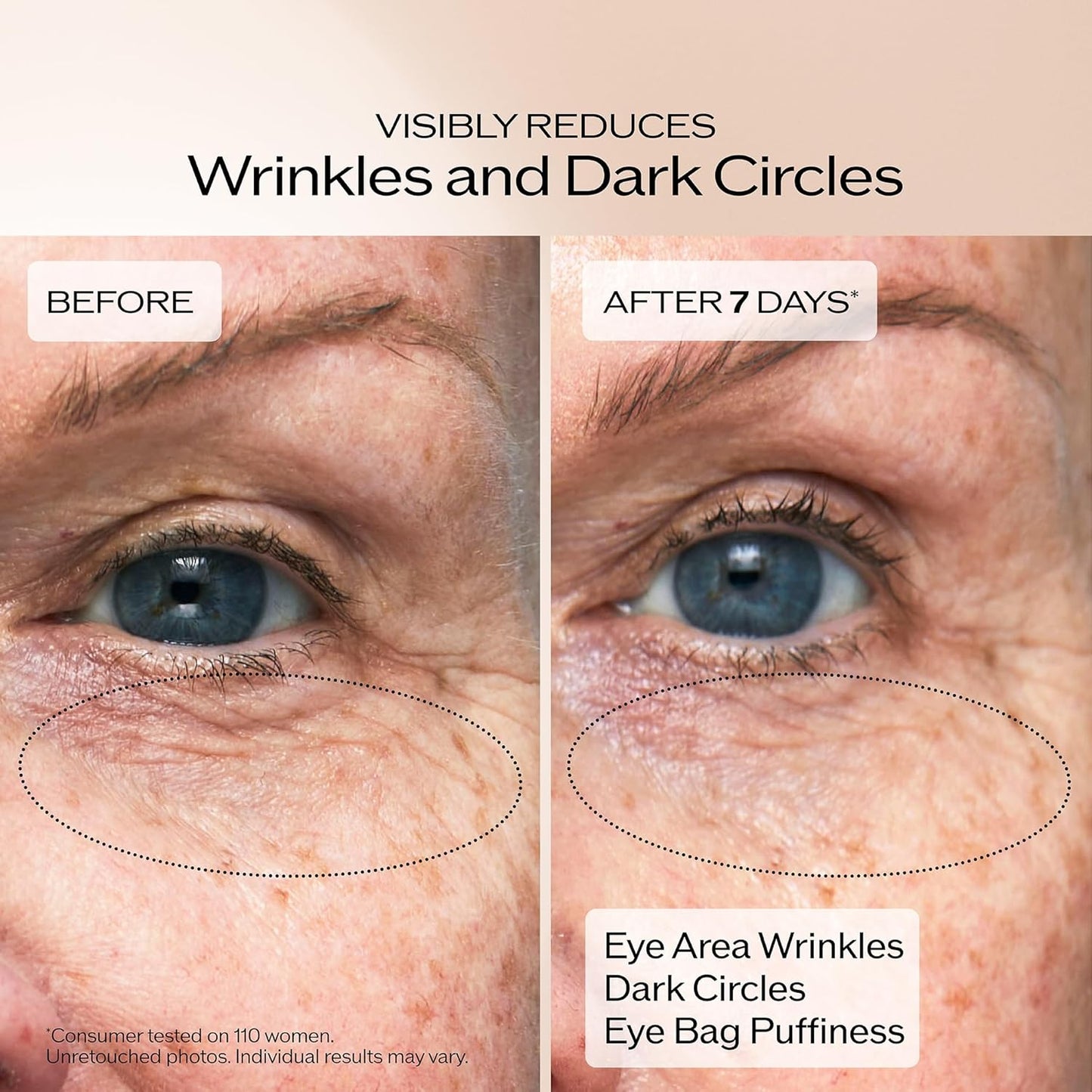 HotShiseido Benefiance Wrinkle Smoothing Eye Cream - 15 mL - Visibly Improves Five Types of Eye Wrinkles, Dark Circles & Puffiness - 48-HR Hydration - All Skin Types - Non-Comedogenic