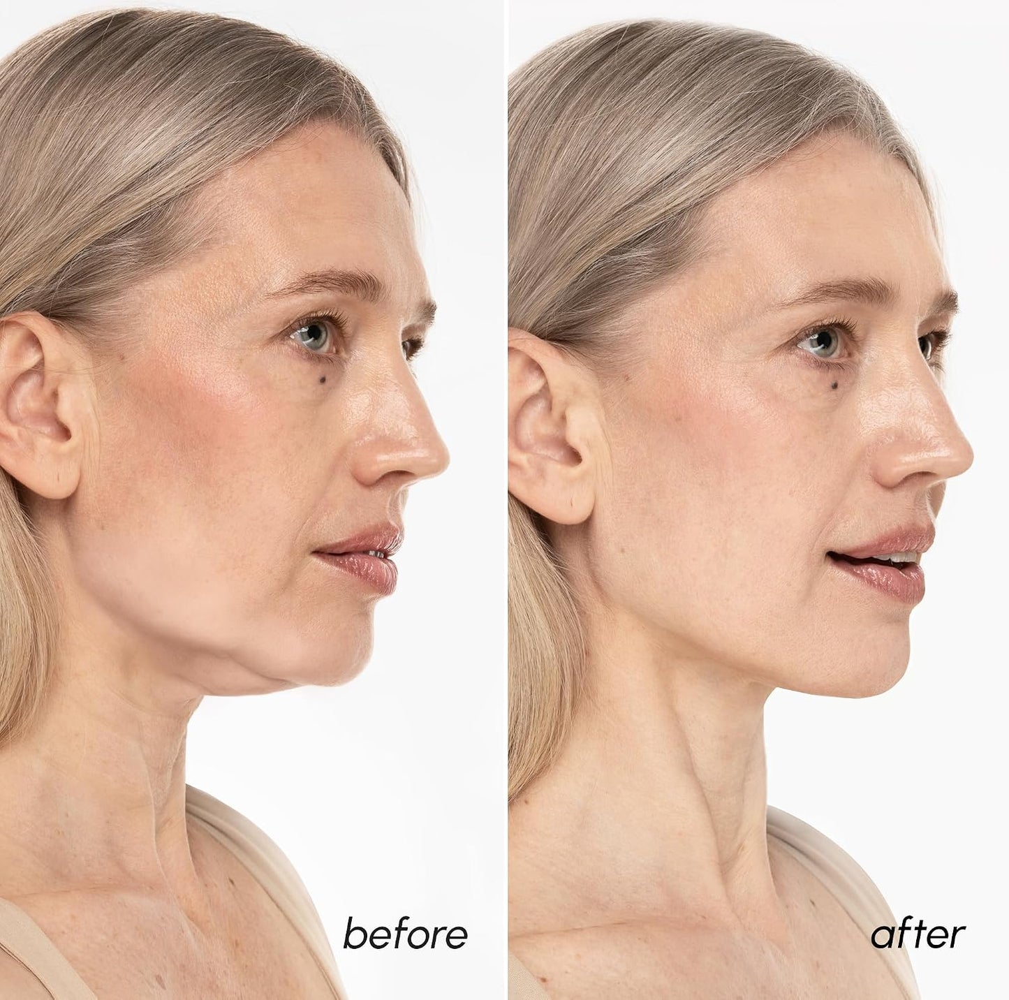 HotMAREE V Line Lifting Mask with 24K Gold – Deep Collagen Face Mask for Women – Jawline Shaper Mask with Retinol & Hyaluronic Acid – Neck Tightening & Firming - Double Chin Strap for Face Lift