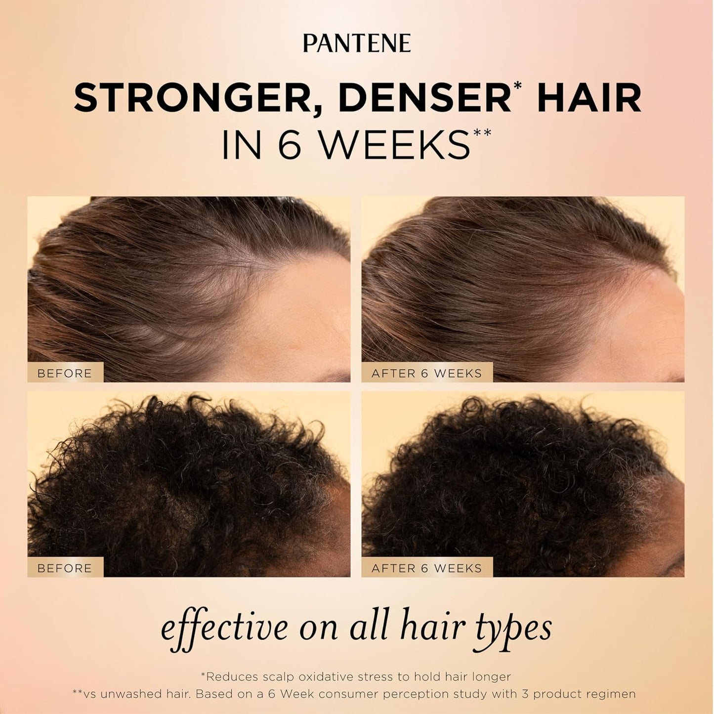 HotPantene Abundant & Strong 3-Piece Regimen with B5 Complex + Niacinamide, Shampoo (13.5 oz), Conditioner (8 oz), Serum (2 oz) for Hair Loss, Thinning, Anti-Breakage, Volume - Grows Healthier