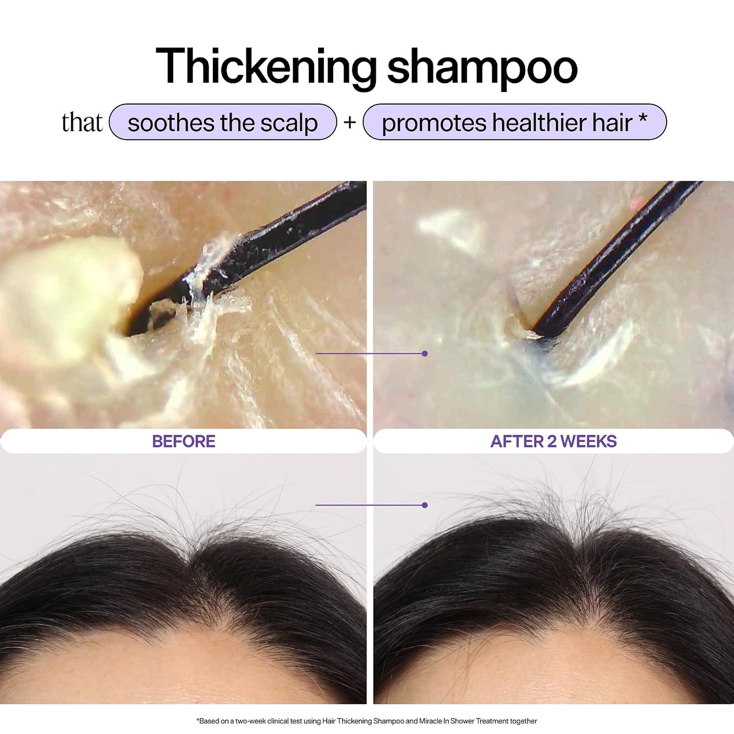 HotDr. Groot Hair Thickening Shampoo, Korean Hair Care with Biotin, Rosemary Oil to Help Volumize Thinning, Damaged Hair, Hydrate Hair and Scalp, Biotin Shampoo, Scalp Revitalizing Solution