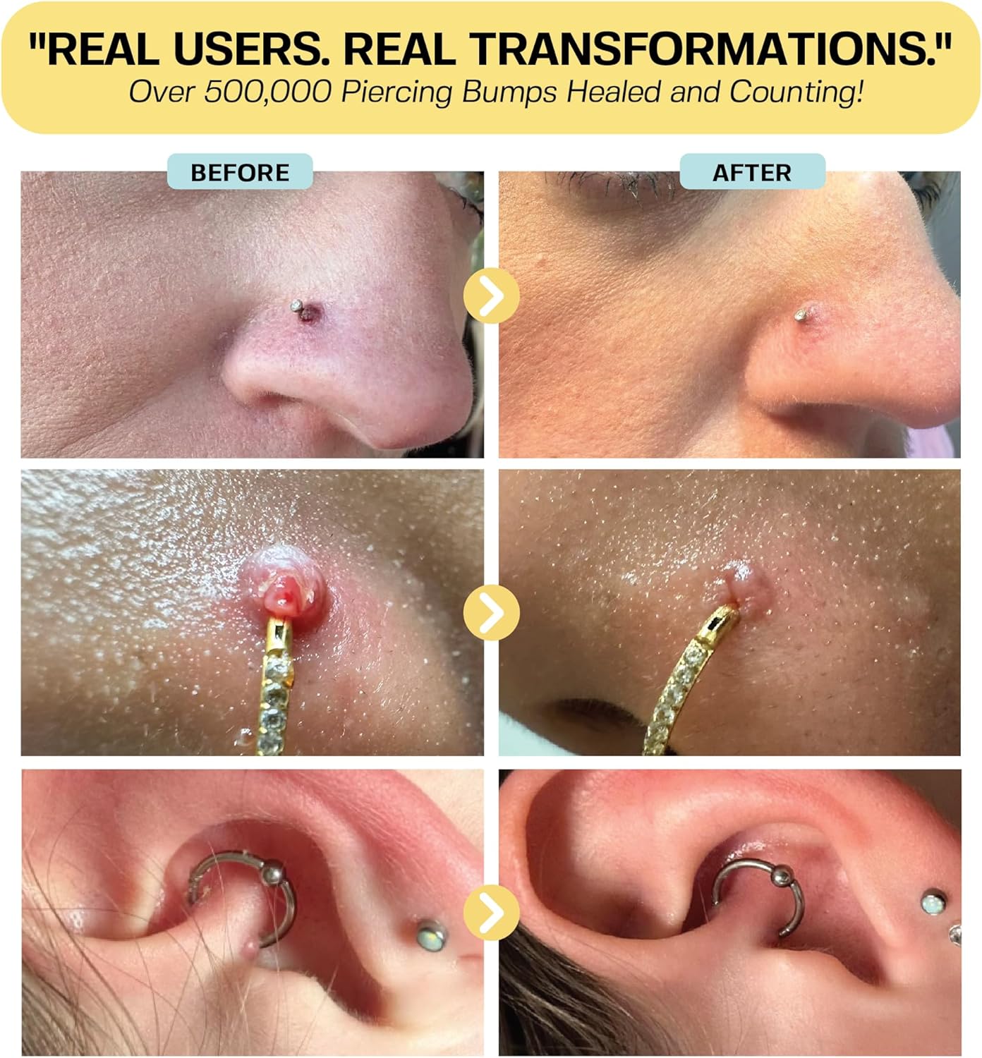 HotBASE LABORATORIES Piercing Bump Solution & Keloid Bump Removal | Soothing Piercing Aftercare for Piercing Bumps & Keloid Scar Removal | Ear & Nose Keloid Bumps Piercing Aftercare Solution Oil | 0.5 oz