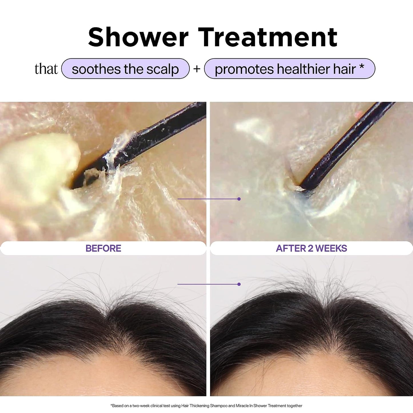 HotDr. Groot Miracle in Shower Moisturizing Treatment for Hair Loss, Korean Hair Care Rinse, Rosemary Oil for Smooth, Healthier-Looking Hair in 5 Seconds, Scalp Revitalizing Solution