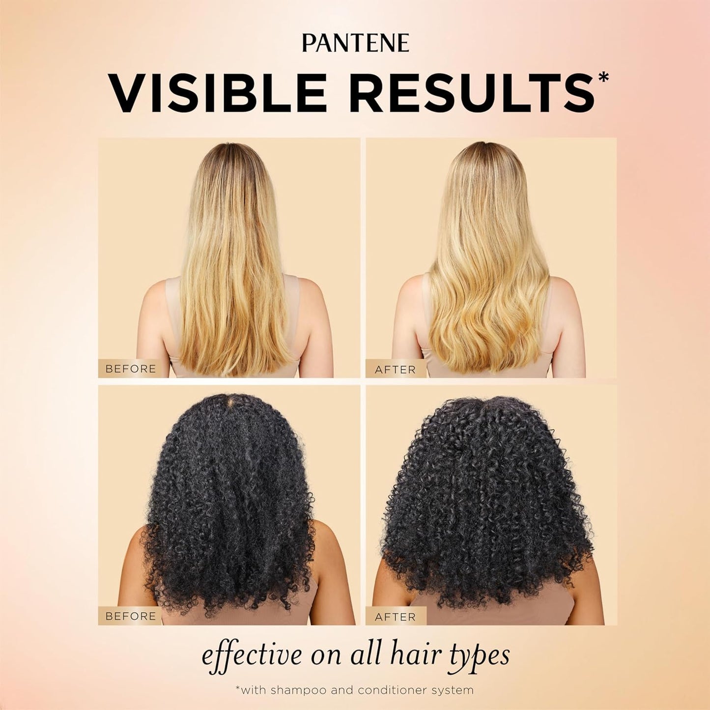HotPantene Abundant & Strong 3-Piece Regimen with B5 Complex + Niacinamide, Shampoo (13.5 oz), Conditioner (8 oz), Serum (2 oz) for Hair Loss, Thinning, Anti-Breakage, Volume - Grows Healthier