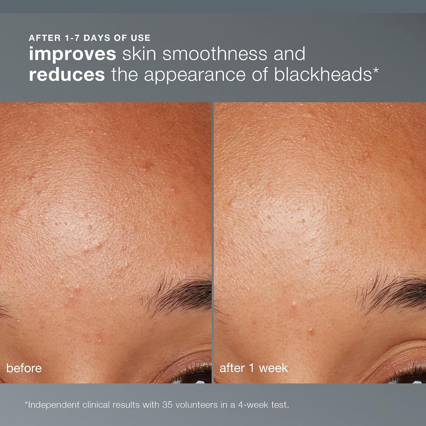 HotDermalogica Daily Microfoliant, Face Exfoliator Scrub Powder with Salicylic Acid and Papaya Enzyme, Achieve Brighter, Smoother Skin Daily