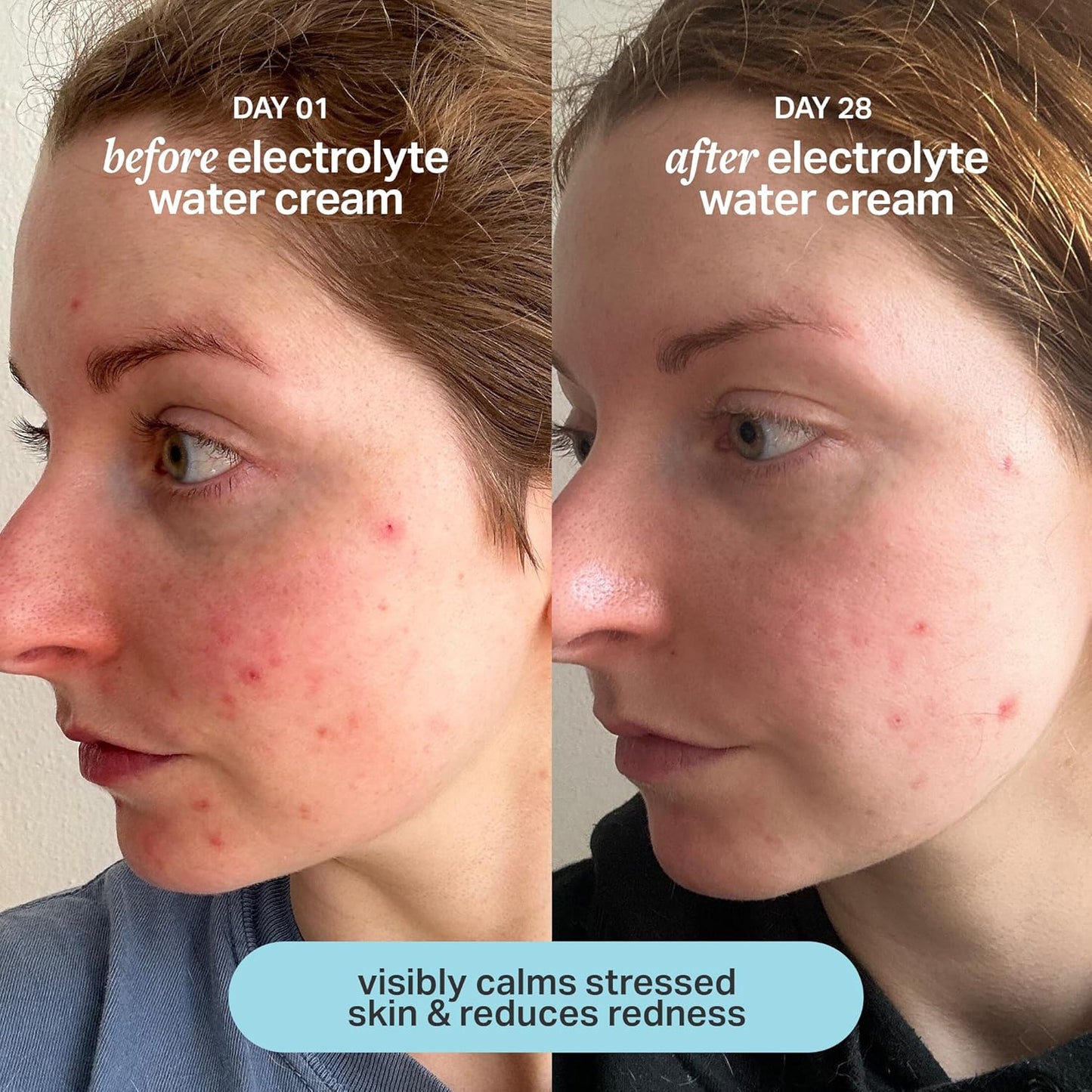 HotCocokind Electrolyte Water Cream | Lightweight Water Gel Moisturizer | Balanced Hydrating Day Cream for All Skin Types | 1.7 Fl Oz