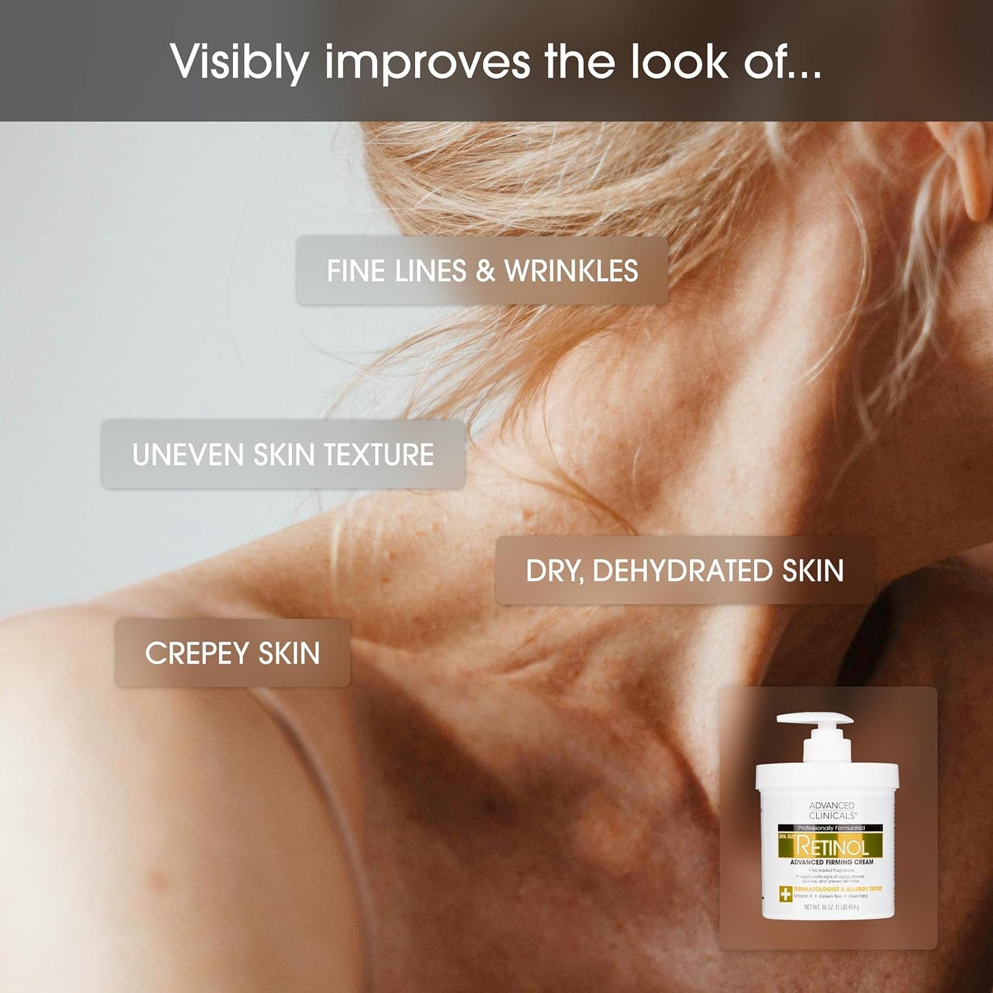 HotAdvanced Clinicals Retinol Body Lotion & Face Moisturizer | Visible Anti Aging Skin Care Retinol Body Cream For Women & Men Targets Look Of Fine Lines, Wrinkles, & Crepe Looking Dry Skin, 16 Ounce