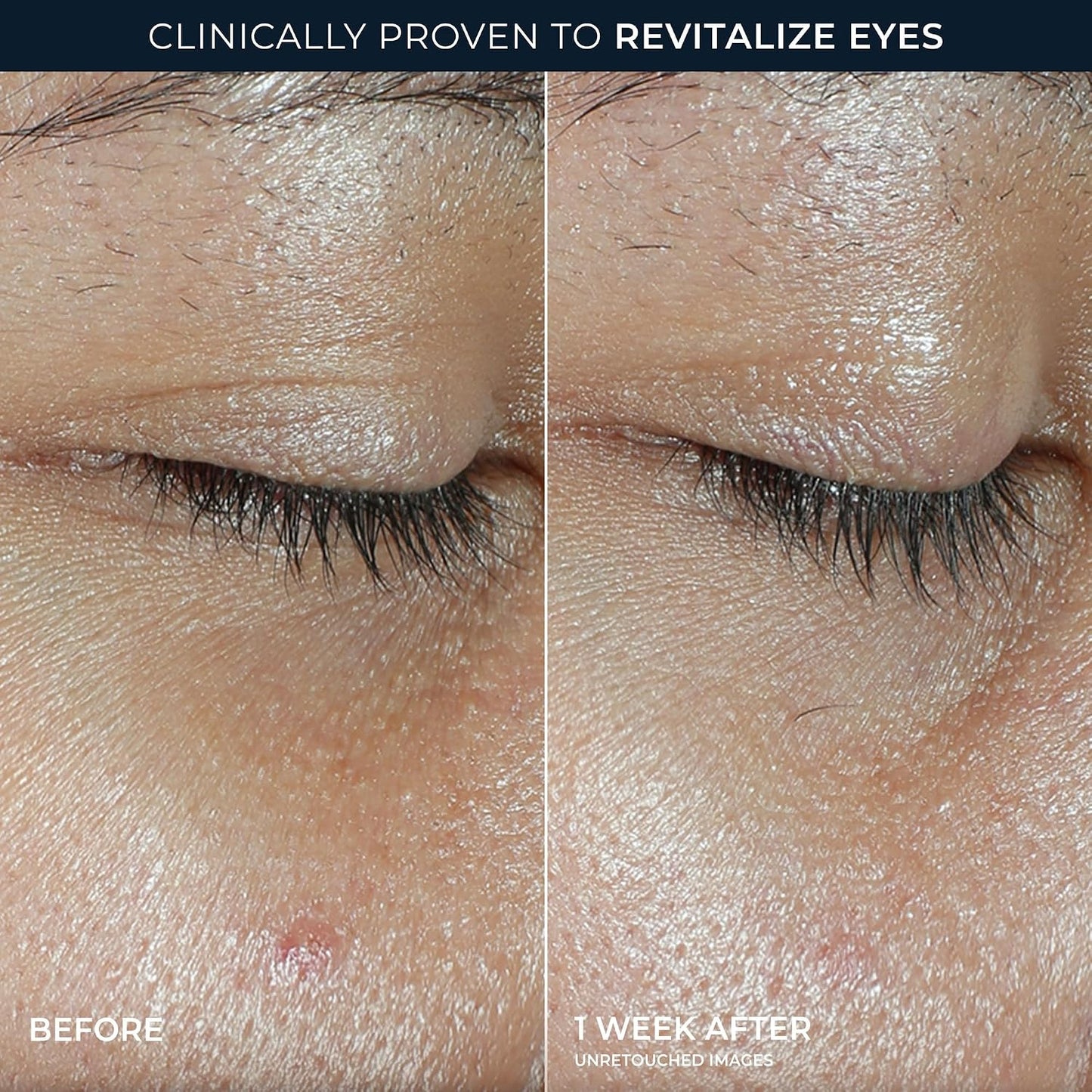 HotRoC Multi Correxion Revive + Glow Eye Balm with Vitamin C (0.14 oz) + Retinol Eye Cream Packette (Packaging May Vary)