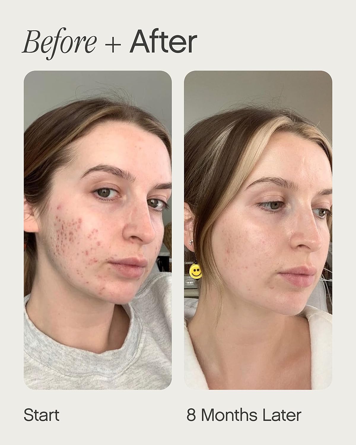 HotTopicals, Faded Brightening Serum, Reduces Discoloration, 0.5 Fl Oz | Clears Post-Blemish Marks, Scars & Spots, Kojic Acid & Niacinamide, Dermatologist-Tested, Vegan