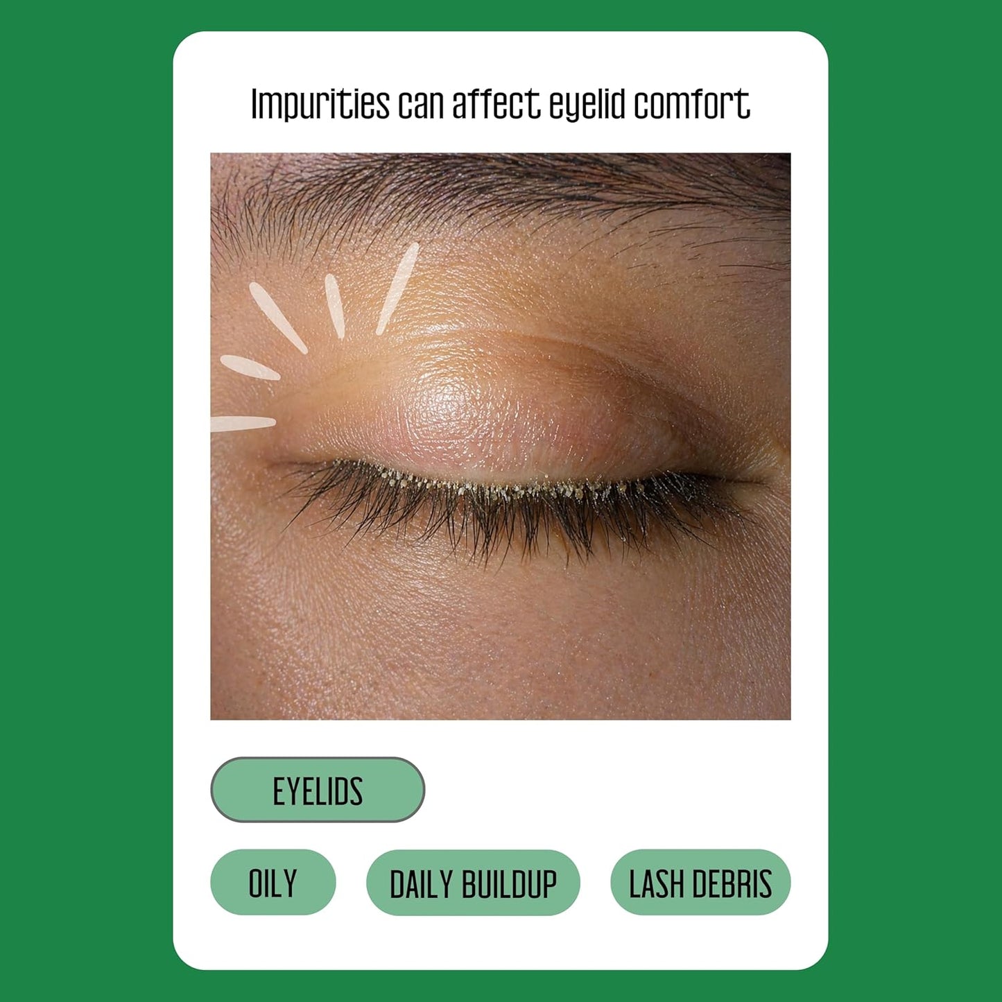 Hot100PCs Tea Tree Eyelid Wipes – Cleaning Eye Wipes for People with Dry Eyes & Allergies – Gentle Eyelid Cleanser with Hyaluronic Acid, Chamomile and Aloe – Individually Wrapped & Biodegradable