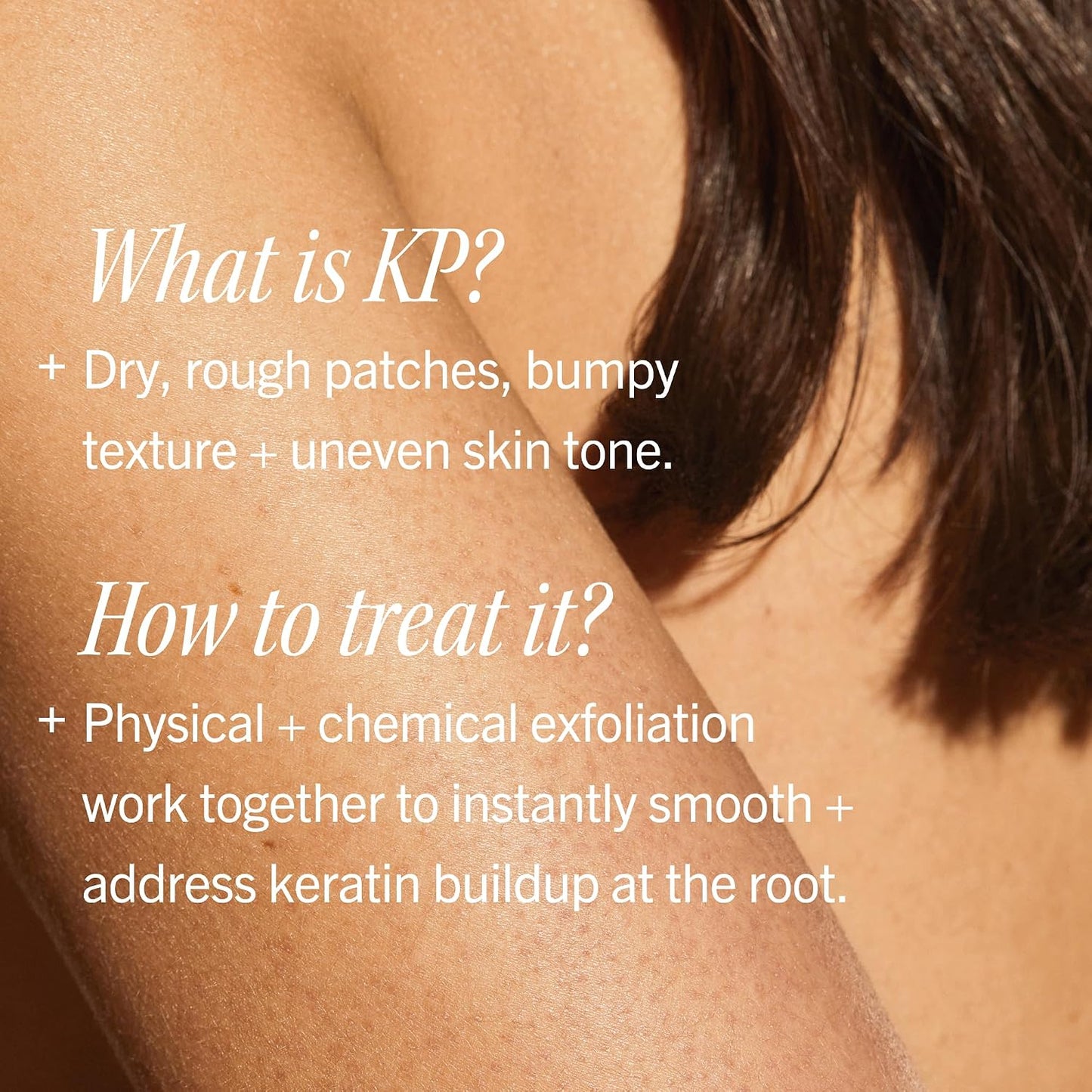 HotFirst Aid Beauty KP Bump Eraser Body Scrub with 10% AHA - Dermatologist-Tested Keratosis Pilaris Exfoliator - Support for Rough Bumps, Uneven Skin Texture & Strawberry Skin - Sensitive Skin