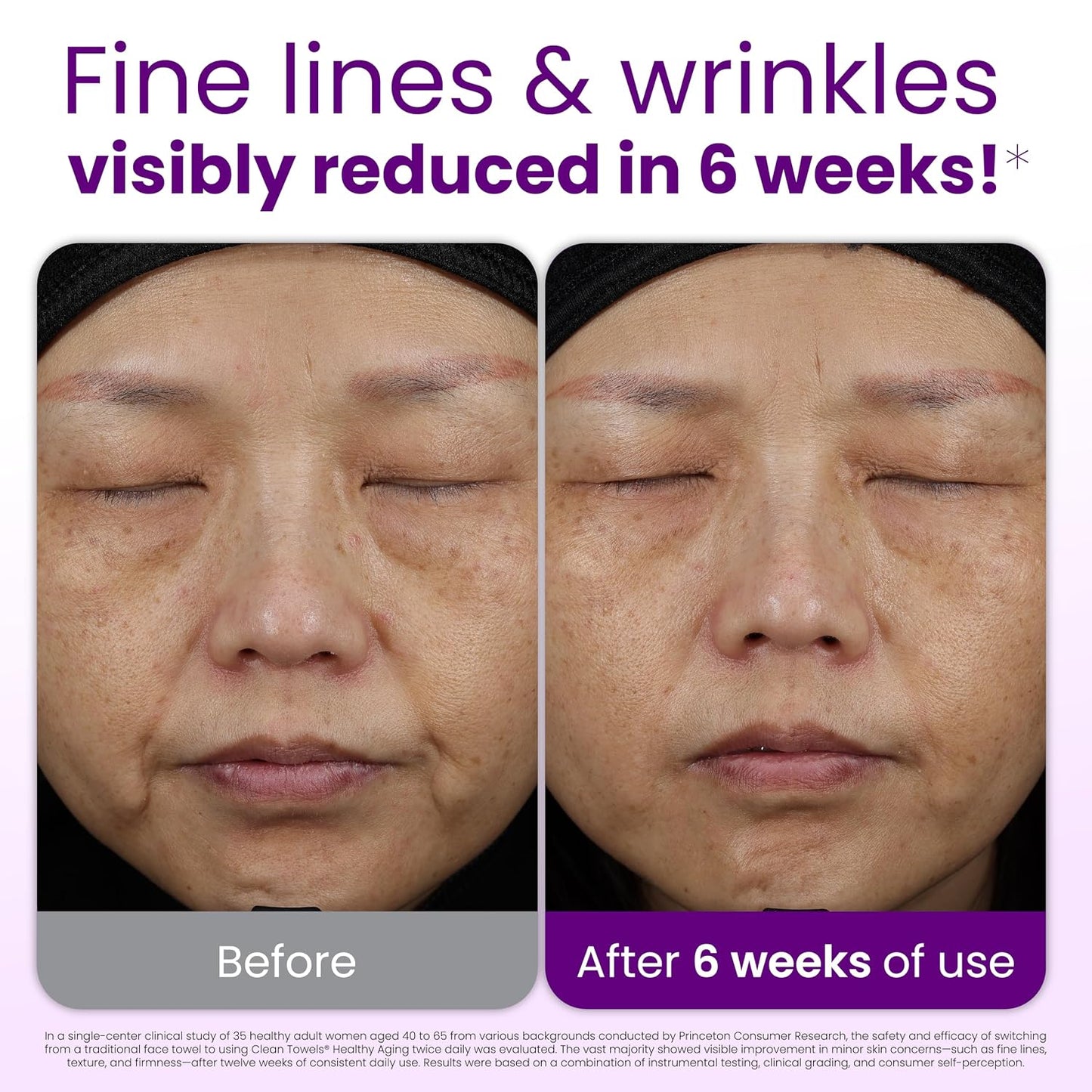 HotReduces Fine Lines and Wrinkles in 6 weeks or Less, CLEAN SKIN CLUB Healthy Aging Clean Towels® XL, Disposable Face Towels, XL - 1 Pack (50 count)