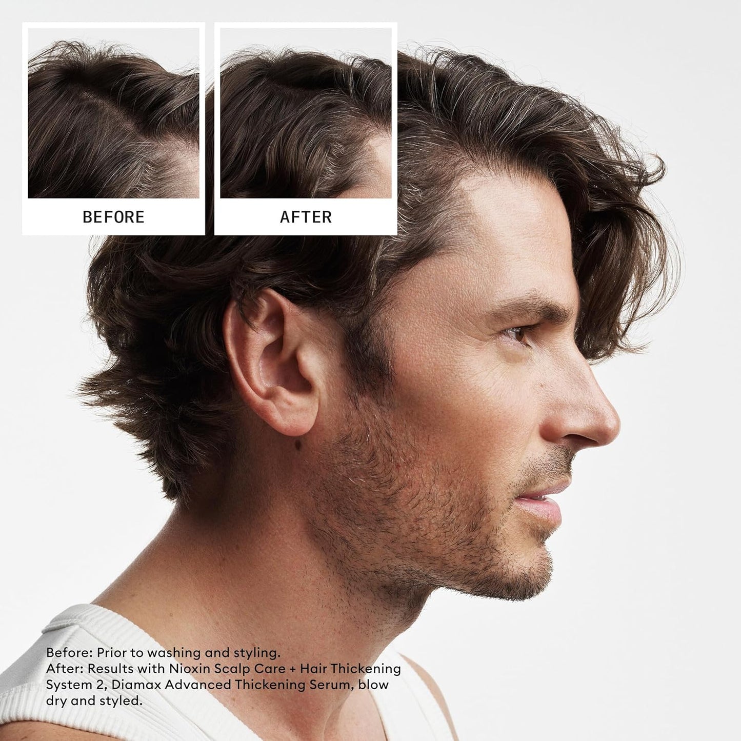 HotNIOXIN System 2 | Scalp Care | Shampoo | Hair Thickening | For Natural Hair | Scalp Health | For Natural Hair with Progressed Thinning | Cleanse & Boost Hair Density with Niacinamide & Biotin