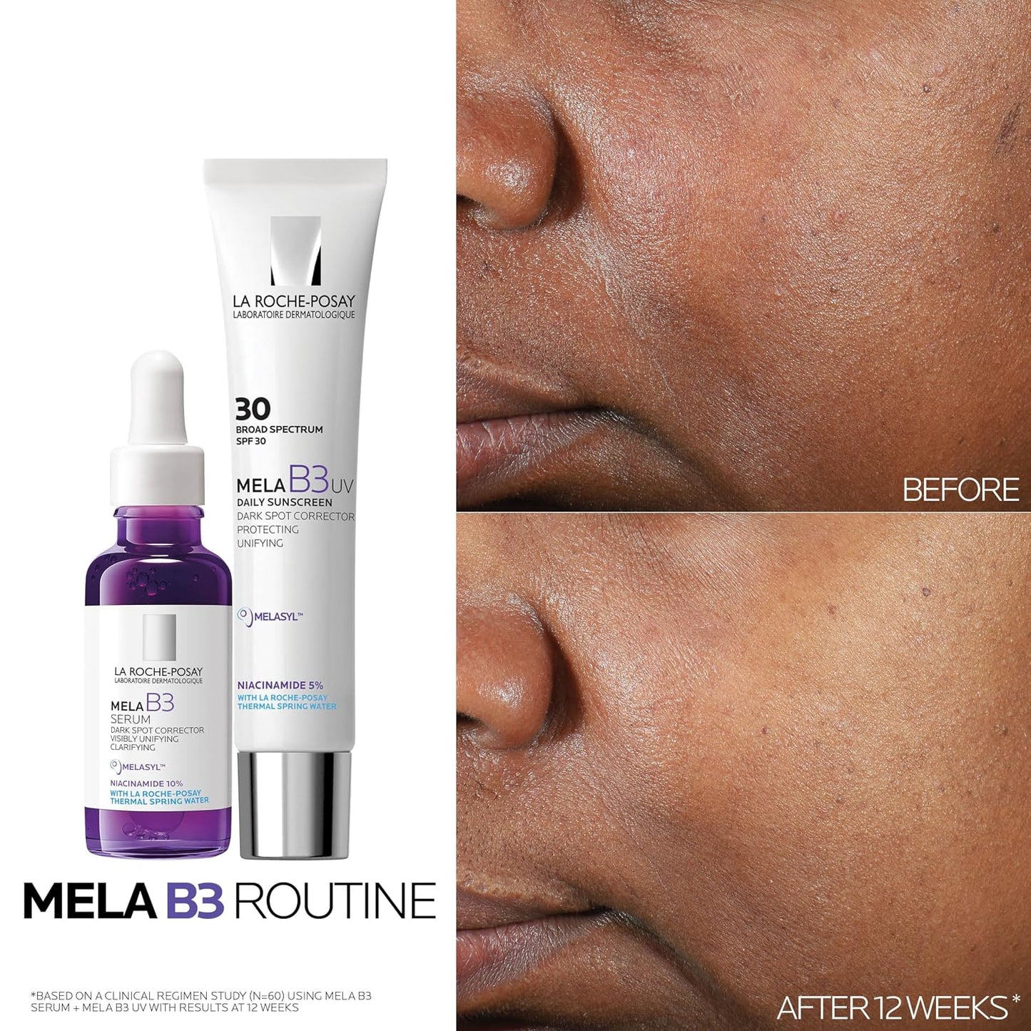 HotLa Roche-Posay Mela B3 Dark Spot Face Serum with 10% Niacinamide, 1oz | Anti-aging dark spot correcting face serum with Melasyl™ for sun spots, age spots, and post-acne marks. Lightweight texture.