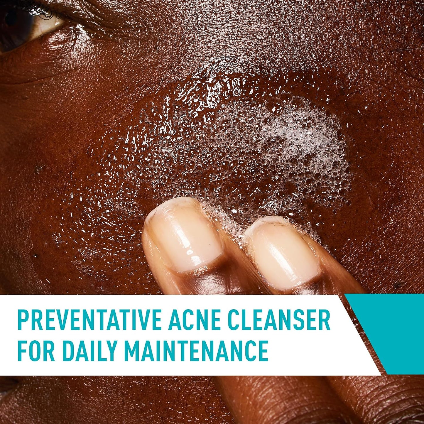 HotCeraVe Acne Control Cleanser, 2% Salicylic Acid Treatment Formulated With Niacinamide + Ceramides + Oil Absorbing Clay, Gentle Face Wash Helps Clear & Prevent Acne, Fragrance Free, 16 Ounce